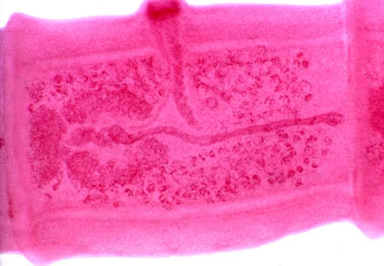 taenia gravid proglottid