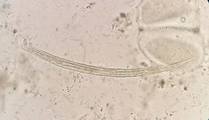 Threadworm - Troccap