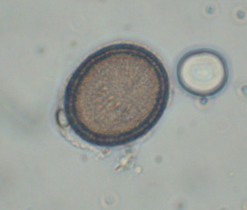 Echinococcus Granulosus Egg Echinococcus Granulosus Egg